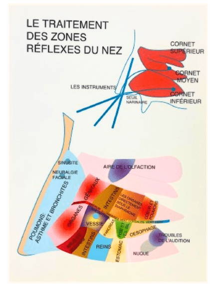 J. V. Baarle 15X21 Zone Réflexe Nez - Fr - Plastifiée